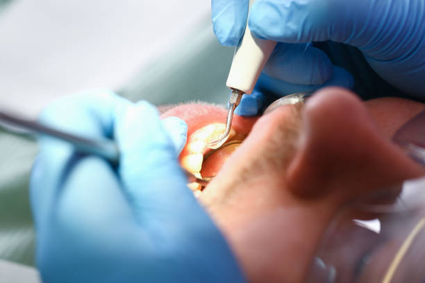 Best Emergency Dentist for Knocked-Out Tooth in Evansdale, IA